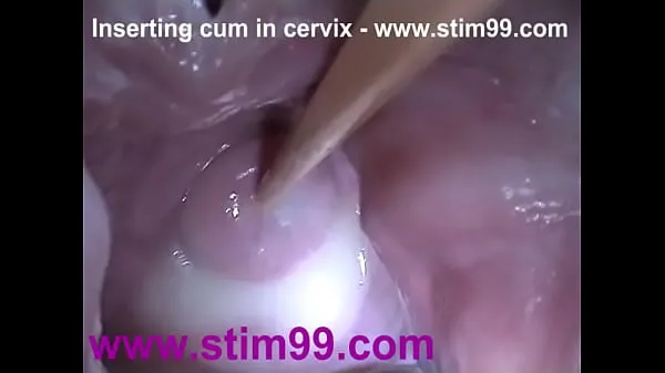 HD Insertion Semen Cum im Cervix Wide Stretching Pussy SpeculumPower-Clips