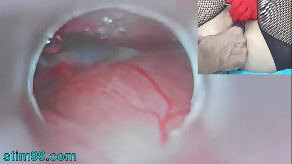 HD Uncensored Japanese Insemination with Cum into Uterus and Endoscope Camera by Cervix to watch inside womb power Clips